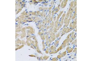 Immunohistochemistry of paraffin-embedded mouse heart using CRHBP antibody at dilution of 1:100 (40x lens). (CRHBP antibody)