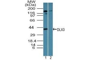 Image no. 1 for anti-Distal-Less Homeobox 3 (DLX3) (AA 220-270) antibody (ABIN960137) (DLX3 antibody  (AA 220-270))
