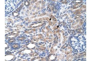 SLC29A2 antibody was used for immunohistochemistry at a concentration of 4-8 ug/ml to stain Epithelial cells of renal tubule (arrows) in Human Kidney.