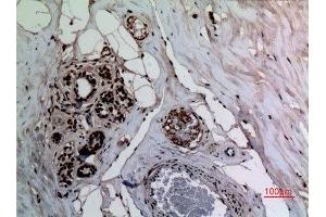 Immunohistochemistry (IHC) analysis of paraffin-embedded Human Breast, antibody was diluted at 1:100. (NF-kB p65 antibody  (acLys314, acLys315))