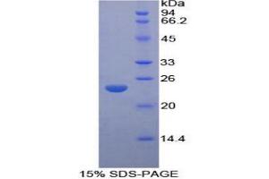 SDS-PAGE analysis of Rat LMP7 Protein.