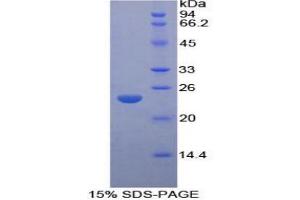 SDS-PAGE analysis of Rat LMP7 Protein. (PSMB8 Protein)