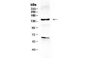 Western blot analysis of ErbB 2 using anti- ErbB 2 antibody . (ErbB2/Her2 antibody  (N-Term))