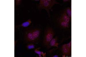 Immunofluorescence staining of methanol-fixed HeLa cells using JunB (Phospho-Ser79) Antibody (E011026, Red) (JunB antibody  (pSer79))