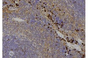 ABIN6279104 at 1/100 staining Human lymph node tissue by IHC-P. (AKR1C4 antibody)
