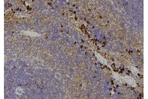 ABIN6279104 at 1/100 staining Human lymph node tissue by IHC-P.