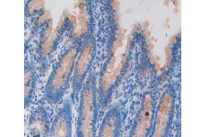 Used in DAB staining on fromalin fixed paraffin- embedded intestine tissue (KRT20 antibody  (AA 75-382))