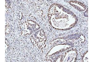 IHC analysis of MCM6 using anti-MCM6 antibody (ABIN7600038). (MCM6 antibody  (AA 14-821))