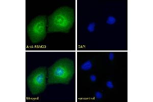 ABIN571262 Immunofluorescence analysis of paraformaldehyde fixed U2OS cells, permeabilized with 0. (RBM20 antibody  (AA 717-727))