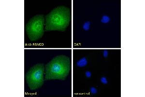 ABIN571262 Immunofluorescence analysis of paraformaldehyde fixed U2OS cells, permeabilized with 0. (RBM20 antibody  (AA 717-727))
