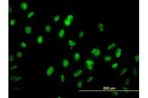 Image no. 1 for anti-GA Binding Protein Transcription Factor, alpha Subunit 60kDa (GABPA) (AA 1-101) antibody (ABIN598704) (GABPA antibody  (AA 1-101))