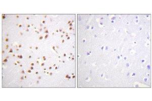 Immunohistochemistry (IHC) image for anti-Catenin (Cadherin-Associated Protein), delta 1 (CTNND1) (Tyr228) antibody (ABIN1848016) (CTNND1 antibody  (Tyr228))