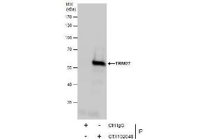 IP Image Immunoprecipitation of TRIM27 protein from Jurkat whole cell extracts using 5 μg of TRIM27 antibody, Western blot analysis was performed using TRIM27 antibody, EasyBlot anti-Rabbit IgG  was used as a secondary reagent.