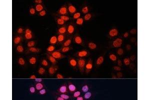 Immunofluorescence analysis of HeLa cells using GABPA Polyclonal Antibody at dilution of 1:100 (40x lens). (GABPA antibody)