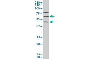 SESN1 polyclonal antibody (A01), Lot # ABNOVA060616QCS1 Western Blot analysis of SESN1 expression in Hela S3 NE . (SESN1 antibody  (AA 271-370))