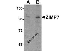Western Blotting (WB) image for anti-Zinc Finger, MIZ-Type Containing 2 (ZMIZ2) (Middle Region) antibody (ABIN1031174) (ZMIZ2 antibody  (Middle Region))