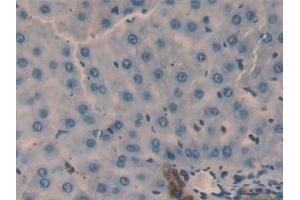 Detection of GAL2 in Rat Liver Tissue using Polyclonal Antibody to Galectin 2 (GAL2) (Gallinacin-2 (GAL2) (AA 1-130) antibody)
