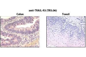 Immunohistochemistry detection of endogenous TRAIL-R3 in paraffin-embedded human carcinoma tissues (colon, tonsil) using mAb to TRAIL-R3 (TR3.
