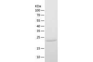 Western Blotting (WB) image for Ubiquitin Specific Peptidase 35 (USP35) (AA 56-264) protein (His tag) (ABIN7284158) (USP35 Protein (AA 56-264) (His tag))