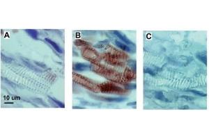 Immunohistochemistry (IHC) image for anti-Keyhole Limpet Hemocyanin (KLH) antibody (ABIN93503) (KLH antibody)