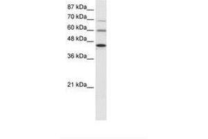 Image no. 1 for anti-Protein Arginine Methyltransferase 3 (PRMT3) (AA 221-270) antibody (ABIN6736023)
