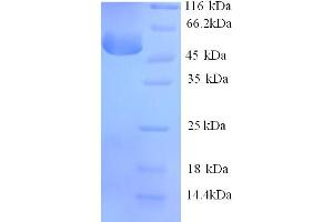 SDS-PAGE (SDS) image for serpin Peptidase Inhibitor, Clade A (Alpha-1 Antiproteinase, Antitrypsin), Member 6 (SERPINA6) (AA 23-405) protein (His tag) (ABIN5713822)