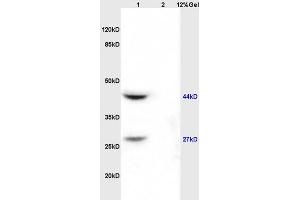 Lane 1: rat kidney lysates Lane 2: rat brain lysates probed with Anti AVPR2 Polyclonal Antibody, Unconjugated (ABIN674619) at 1:200 in 4 °C. (DIABLO antibody  (AA 131-239))