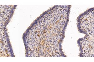 Detection of TGM2 in Human Uterus Tissue using Polyclonal Antibody to Transglutaminase 2 (TGM2) (Transglutaminase 2 antibody  (AA 1-687))