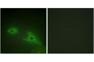 Immunofluorescence analysis of HeLa cells, using EPHA1 Antibody. (EPHA1 antibody  (AA 541-590))