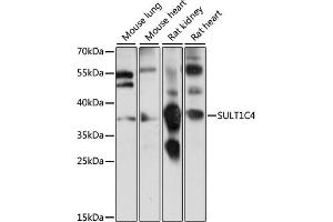 Western blot analysis of extracts of various cell lines, using SULT1C4 antibody (ABIN7270630) at 1:1000 dilution. (SULT1C4 antibody  (AA 1-95))