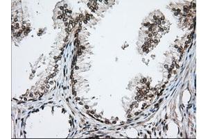 Immunohistochemical staining of paraffin-embedded Human pancreas tissue using anti-TACC3 mouse monoclonal antibody. (TACC3 antibody)