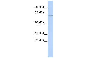 Carboxylesterase 7 antibody used at 1 ug/ml to detect target protein. (CES5A antibody  (Middle Region))