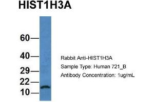 Host: Rabbit Target Name: HIST1H3A Sample Type: Human 721_B Antibody Dilution: 1. (HIST1H3A antibody  (N-Term))