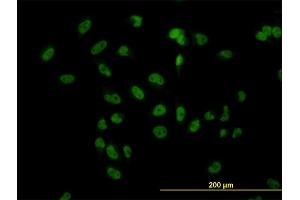 Immunofluorescence of monoclonal antibody to TBL1XR1 on HeLa cell. (TBL1XR1 antibody  (AA 81-178))