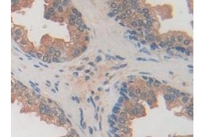 Detection of USP7 in Human Prostate Tissue using Polyclonal Antibody to Ubiquitin Specific Peptidase 7 (USP7) (USP7 antibody  (AA 54-507))