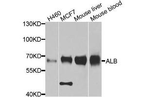 Western blot analysis of extracts of various cell lines, using ALB antibody. (Albumin antibody  (AA 20-255))