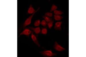 ABIN6267551 staining HeLa by IF/ICC. (STAT2 antibody  (pTyr690))