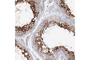 Immunohistochemical staining of human testis with LARP2 polyclonal antibody  shows strong cytoplasmic positivity in seminiferous tubules. (LARP1B antibody)