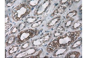 Image no. 1 for anti-Keratin 18 (KRT18) (AA 69-372) antibody (ABIN1491639) (Cytokeratin 18 antibody  (AA 69-372))