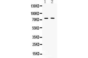 Western blot analysis of TRF2 expression in rat thymus extract ( Lane 1) and COLO320 whole cell lysates ( Lane 2). (TRF2 antibody  (AA 81-287))