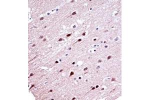 Immunohistochemistry analysis in formalin fixed and paraffin embedded human brain tissue reacted with  KCND2 Antibody (N-term) followed which was peroxidase conjugated to the secondary antibody and followed by DAB staining. (KCND2 antibody  (N-Term))