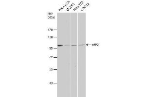 Western Blotting (WB) image for anti-Eukaryotic Translation Elongation Factor 2 (EEF2) antibody (ABIN2855346)