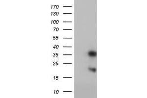 Western Blotting (WB) image for anti-Frataxin (FXN) antibody (ABIN1498335) (Frataxin antibody)