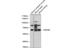 Western blot analysis of extracts of various cell lines, using CHRNB1 antibody (ABIN6131211, ABIN6138587, ABIN6138588 and ABIN6220911) at 1:1000 dilution. (CHRNB1 antibody  (AA 25-235))
