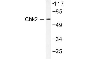 Image no. 1 for anti-Checkpoint Kinase 2 (CHEK2) antibody (ABIN271879) (CHEK2 antibody)