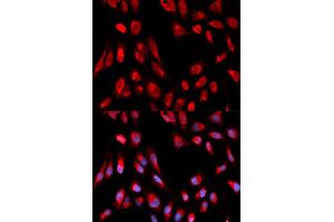 Immunofluorescence (IF) image for anti-Hydroxysteroid (17-Beta) Dehydrogenase 10 (HSD17B10) antibody (ABIN1876636) (HSD17B10 antibody)