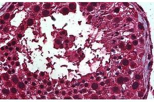 Human Testis: Formalin-Fixed, Paraffin-Embedded (FFPE) (Retinoic Acid Receptor alpha antibody  (AA 315-425))