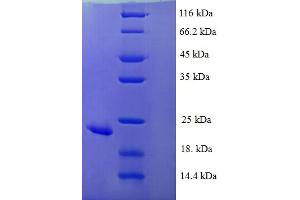 SDS-PAGE (SDS) image for Kruppel-Like Factor 6 (KLF6) (AA 27-207) protein (His tag) (ABIN4975149)