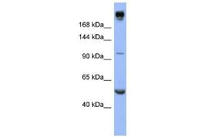 INSR antibody used at 1 ug/ml to detect target protein. (Insulin Receptor antibody  (Middle Region))