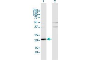 Western Blot analysis of TMEM126B expression in transfected 293T cell line by TMEM126B MaxPab polyclonal antibody. (TMEM126B antibody  (AA 1-200))